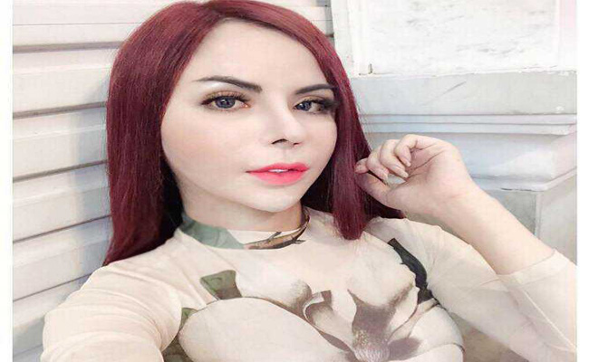  Hotgirl chuyển giới 1 triệu followers bất ngờ chia sẻ ảnh mặt biến chứng sau khi nạo silicon